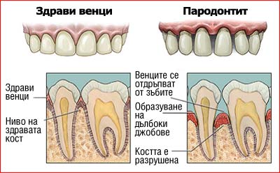 Схема